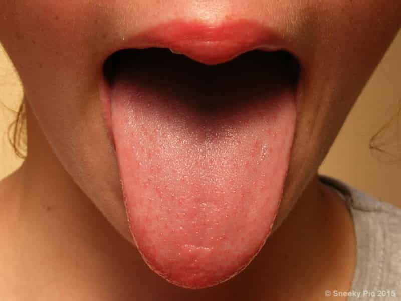 Human Tongue