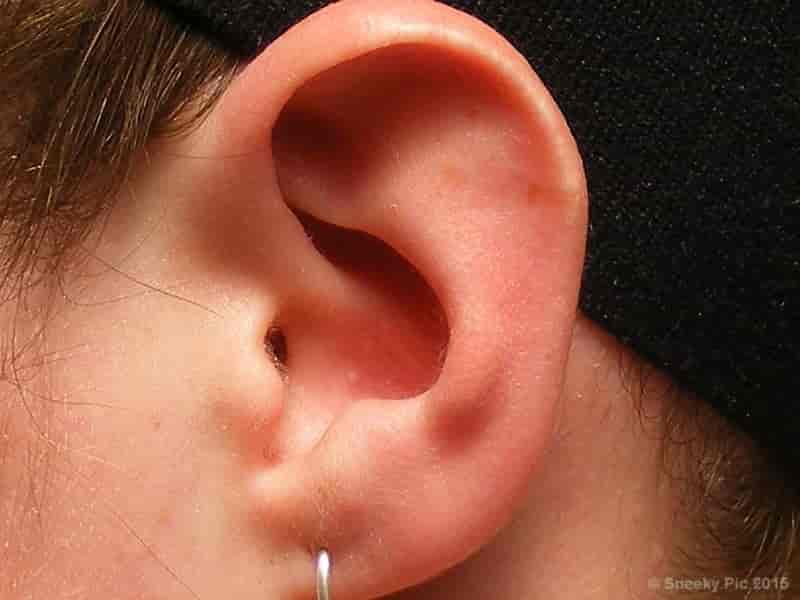 Human Ear
