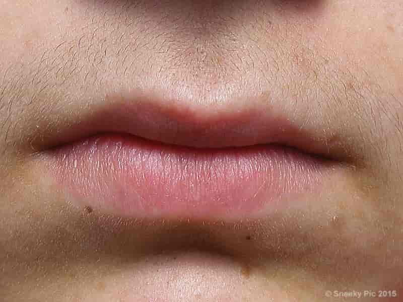 Human Lips